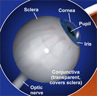 LASIK Eye Diagram