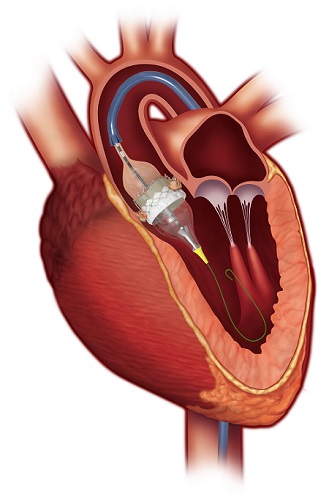 heart diagram 